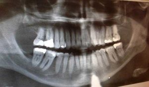 dentisti-troppe-radiografie-inutili