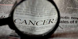 Cancro della pelle il numero di pazienti aumenta