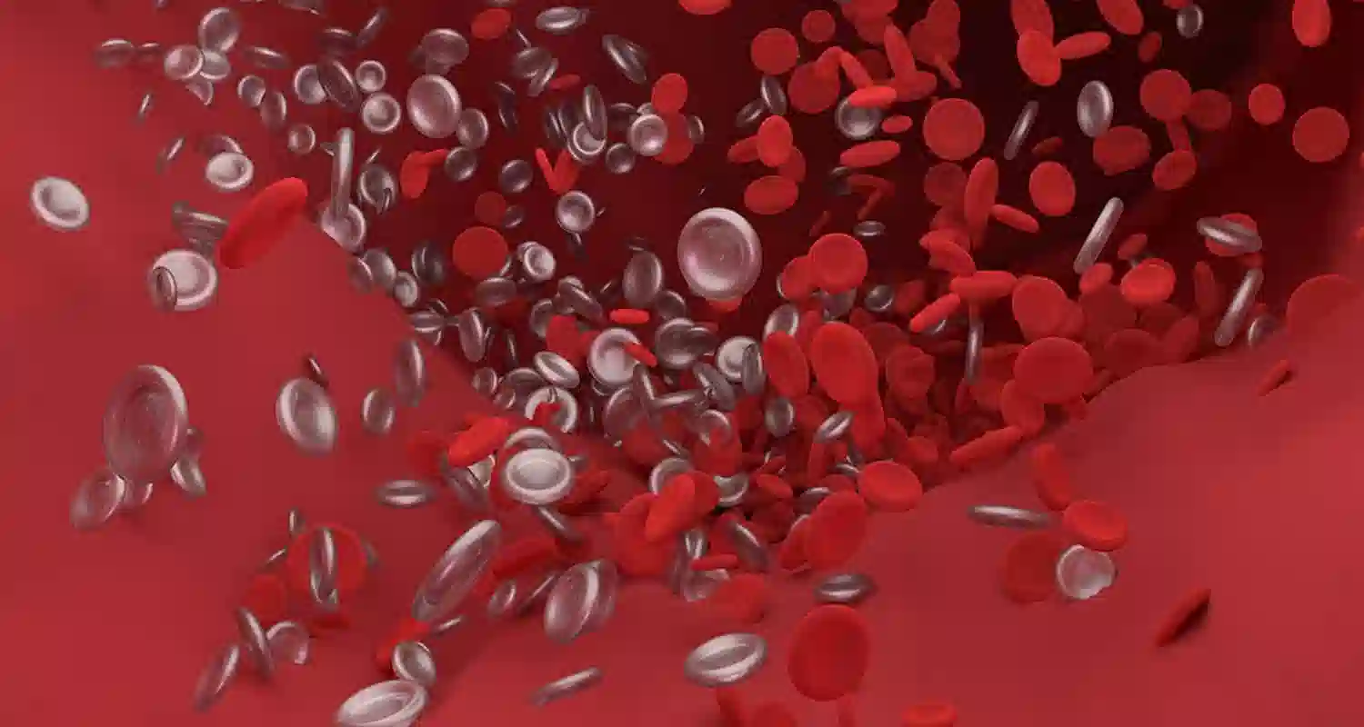 Trombosi venosa profonda riposo assoluto e rimedi