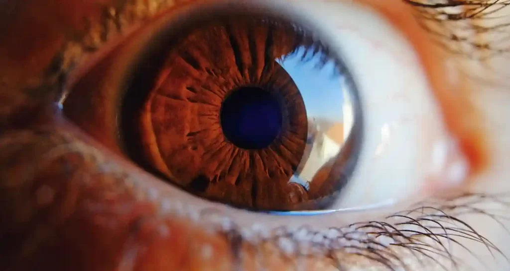 Glaucoma ad insorgenza giovanile