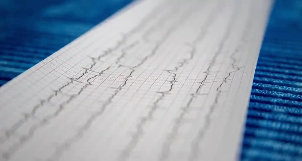 Perche gli attacchi di cuore sono piu comuni a inizio della settimana lavorativa