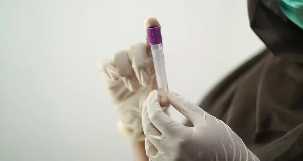 Cosa significa gamma gt nelle analisi del sangue