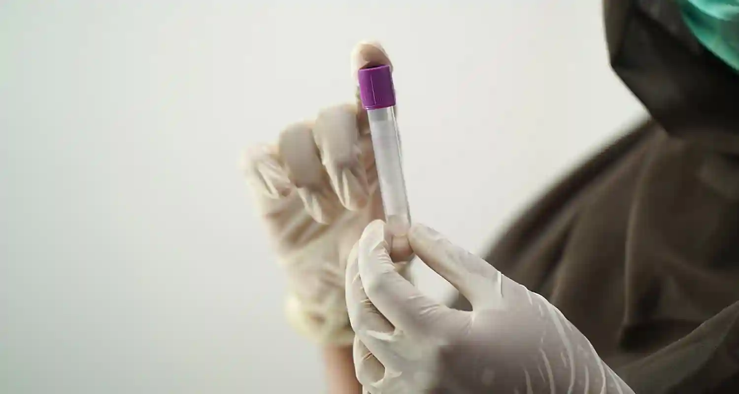 Cosa significa gamma gt nelle analisi del sangue