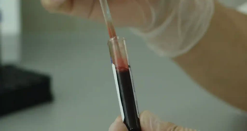 Quali sono le conseguenze di un sistema immunitario iperattivo o ipoattivo