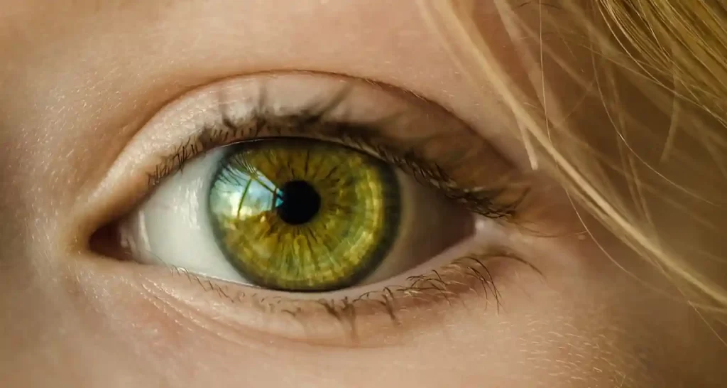 Le cause del glaucoma secondario fattori genetici e non solo